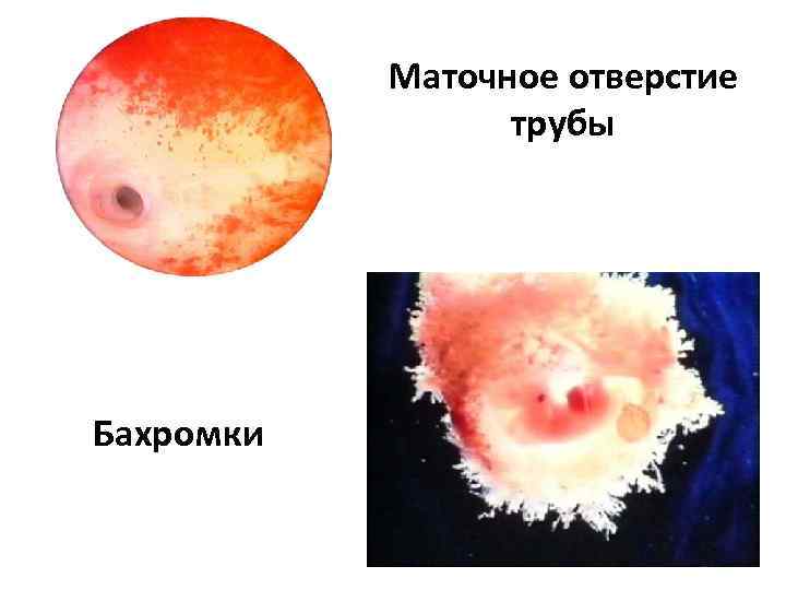 Маточное отверстие трубы Бахромки 
