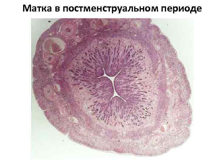 Матка в постменструальном периоде 