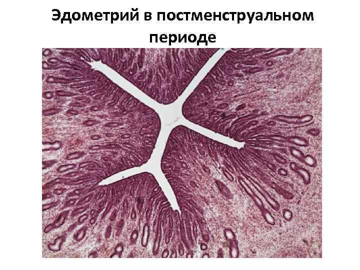 Схема строения женской половой системы