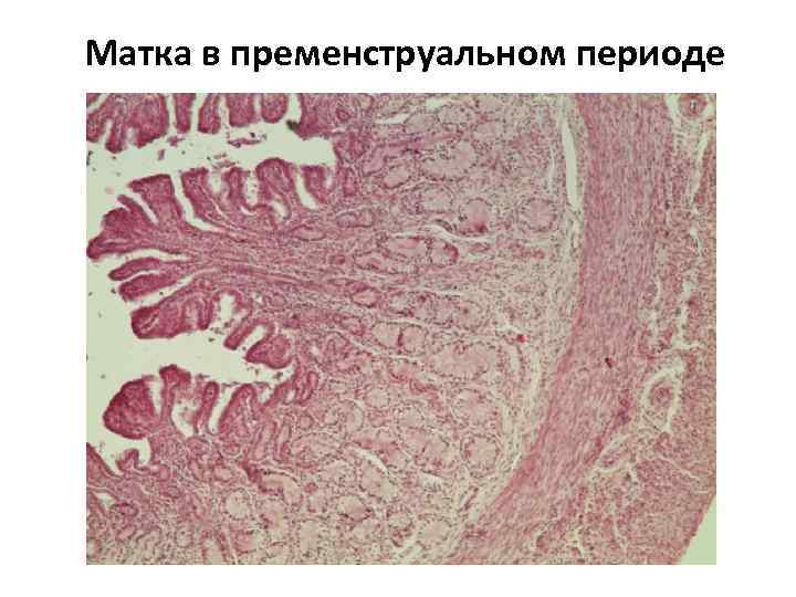 Матка в пременструальном периоде 