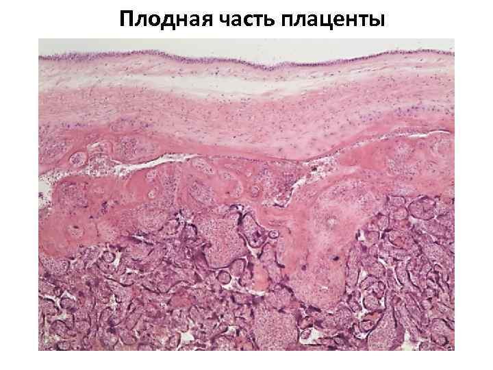 Плодная часть плаценты 