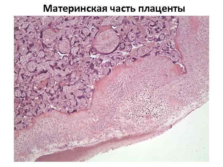 Материнская часть плаценты 