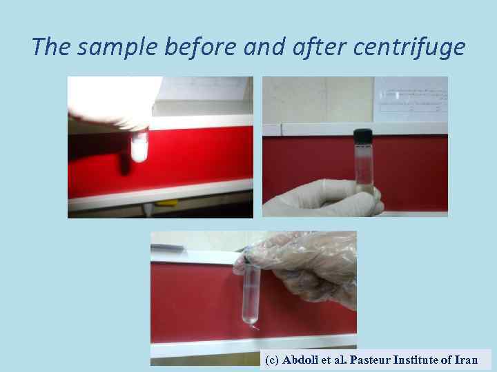 The sample before and after centrifuge (c) Abdoli et al. Pasteur Institute of Iran