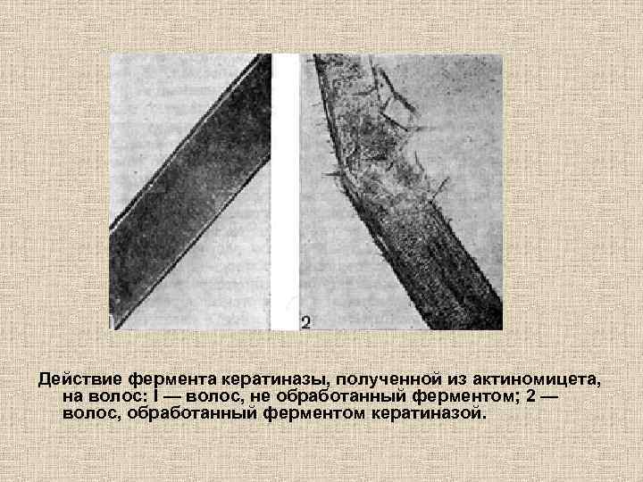 Действие фермента кератиназы, полученной из актиномицета, на волос: I — волос, не обработанный ферментом;