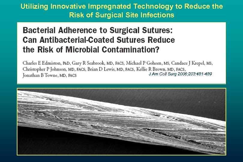 Utilizing Innovative Impregnated Technology to Reduce the Risk of Surgical Site Infections J Am