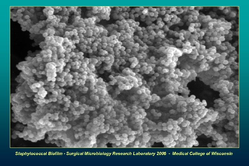 Staphylococcal Biofilm - Surgical Microbiology Research Laboratory 2006 - Medical College of Wisconsin 