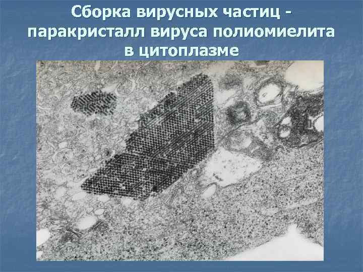 Сборка вирусных частиц паракристалл вируса полиомиелита в цитоплазме 