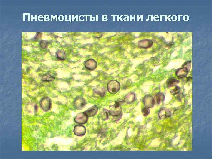 Пневмоцисты в ткани легкого 