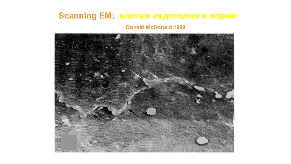 Scanning EM: клетки эндотелия в норме Donald Mc. Donald 1999 X 40, 000 