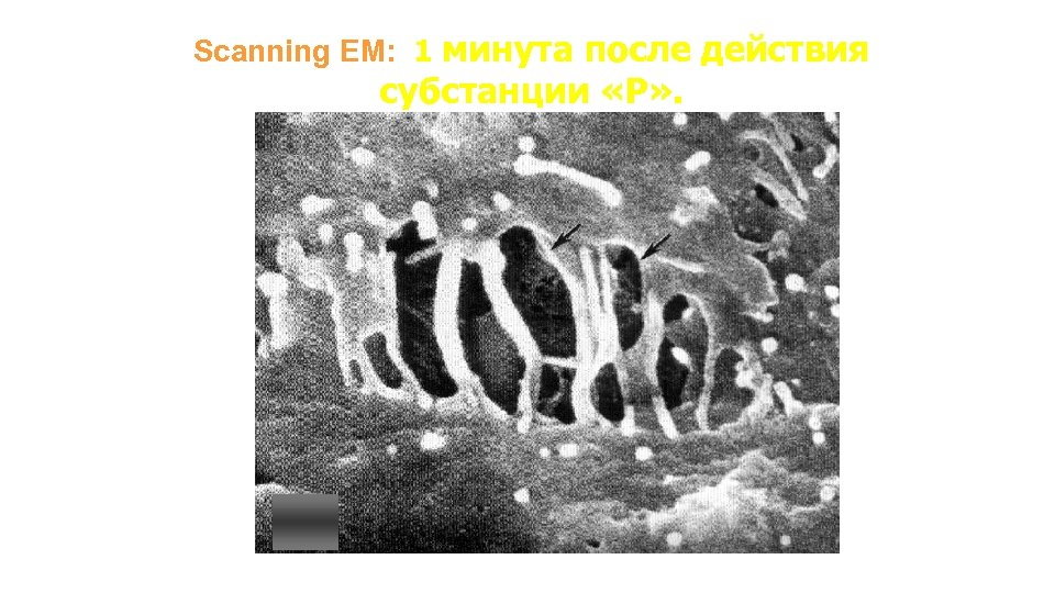 Scanning EM: 1 минута после действия субстанции «P» . 