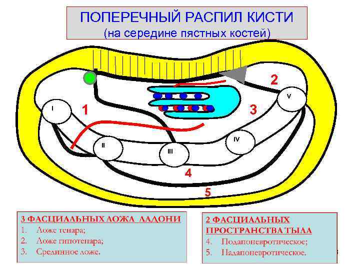 На ладони выделяют фасциальные ложа. Фасциальные ложа кисти схема. Фасциальные ложа ладони топографическая анатомия. Поперечный распил кисти схема топографическая анатомия.