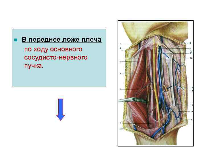 n В переднее ложе плеча по ходу основного сосудисто-нервного пучка. 32 