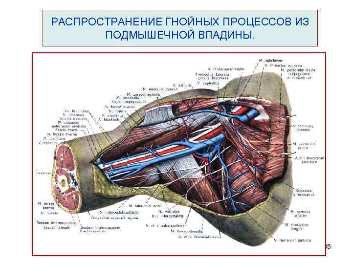 Подмышечная впадина. Распространение гнойных процессов из подмышечной впадины. Пути распространения гноя из подмышечной области. Строение подмышечной впадины. Пути распространения гноя из подмышечной ямки.