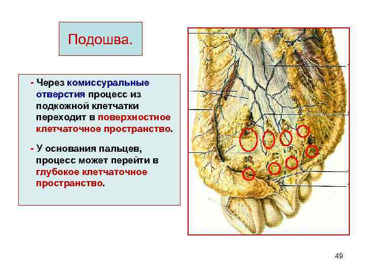 Подошва. - Через комиссуральные отверстия процесс из подкожной клетчатки переходит в поверхностное клетчаточное пространство.