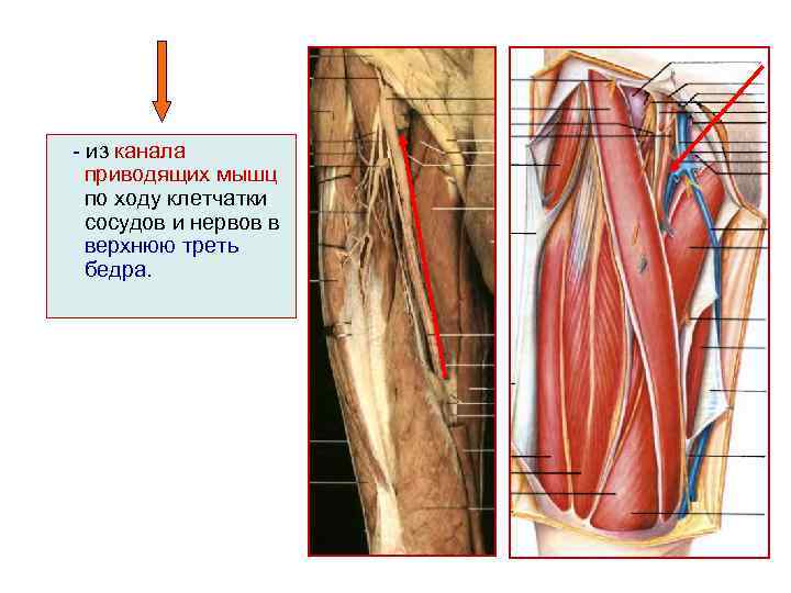 - из канала приводящих мышц по ходу клетчатки сосудов и нервов в верхнюю треть