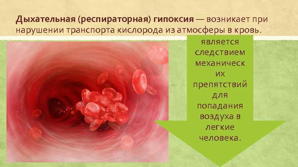 Сердечная гипоксия