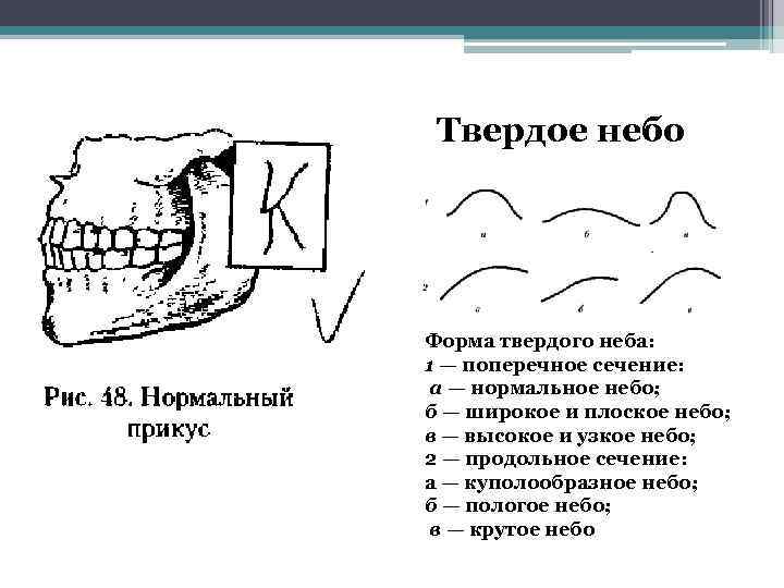 Твердое рисунок. Особенности строения твердого неба.