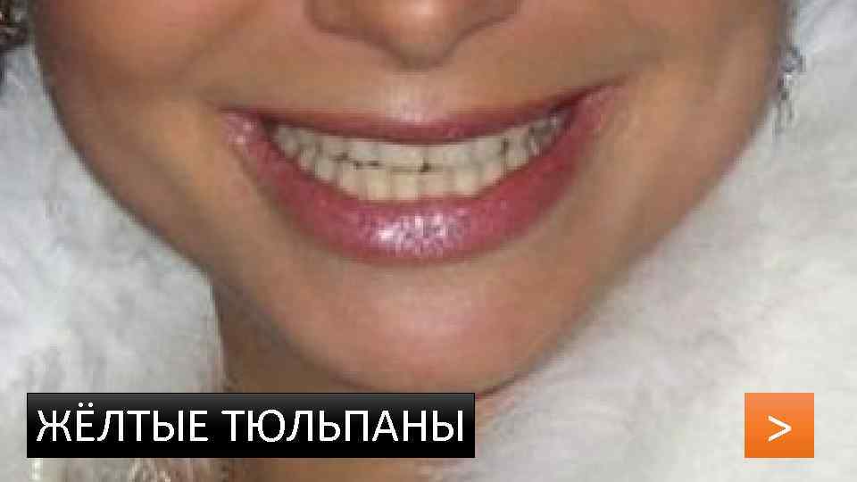 ЖЁЛТЫЕ ТЮЛЬПАНЫ > 