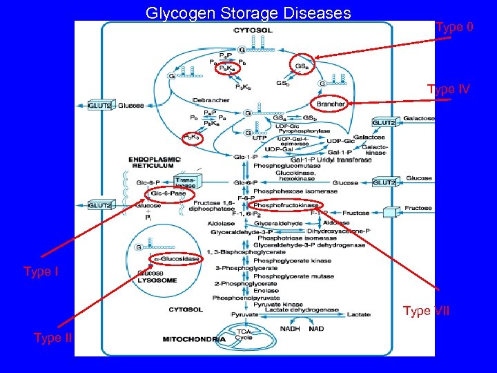 Glycogen Storage Diseases Type 0 Type IV Type I Type VII Type II 