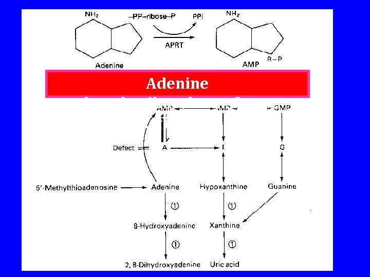 Adenine phosphoribosyltransferase deficiency 