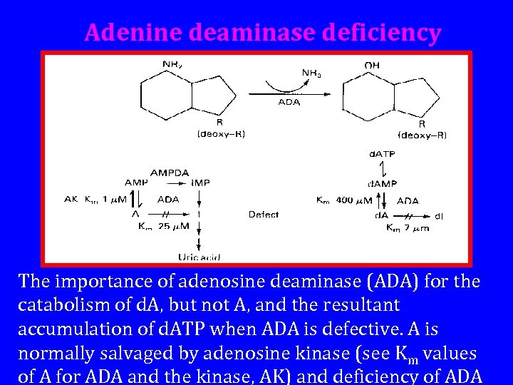 Adenine deaminase deficiency The importance of adenosine deaminase (ADA) for the catabolism of d.