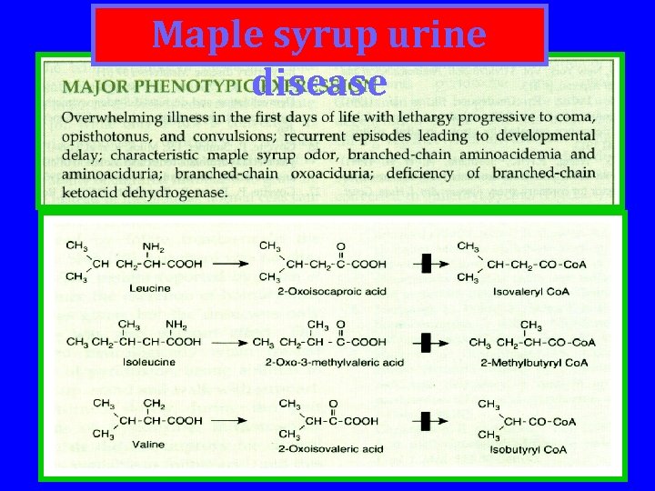 Maple syrup urine disease 