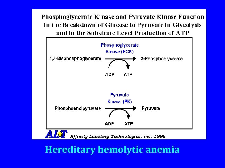 Hereditary hemolytic anemia 