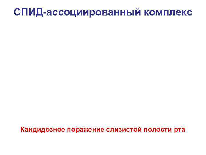 СПИД-ассоциированный комплекс Кандидозное поражение слизистой полости рта 
