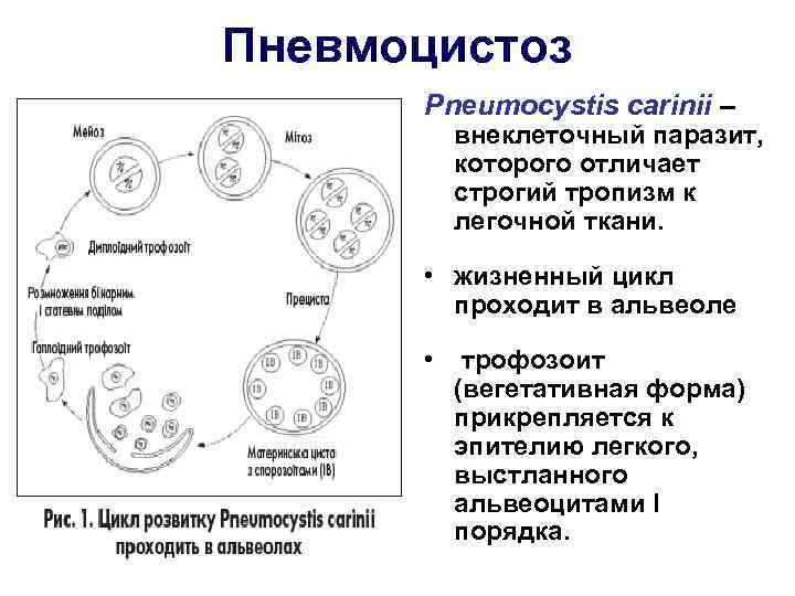 Пневмоцистоз Pneumocystis carinii – внеклеточный паразит, которого отличает строгий тропизм к легочной ткани. •