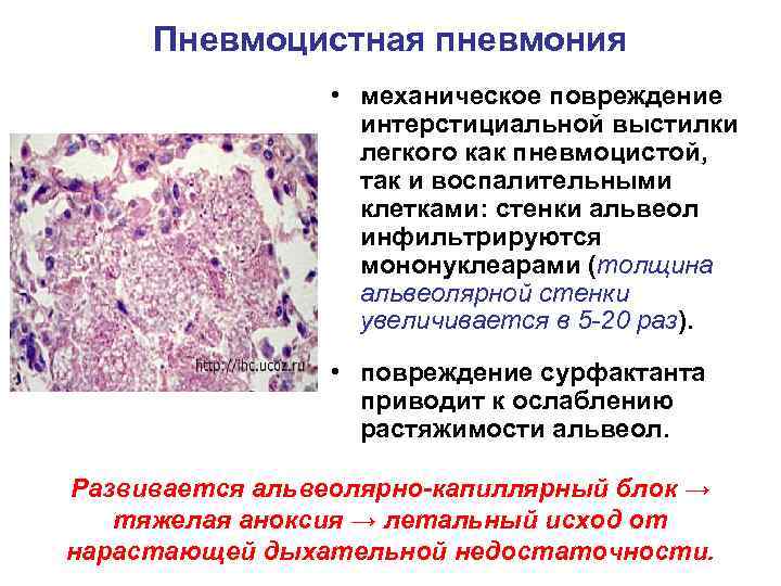 Что такое механическое повреждение ноутбука