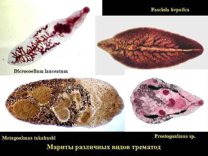 Fasciola hepatica Dicrocoelium lanceatum Metagonimus takahashi Prostogonimus sp. Мариты различных видов трематод 