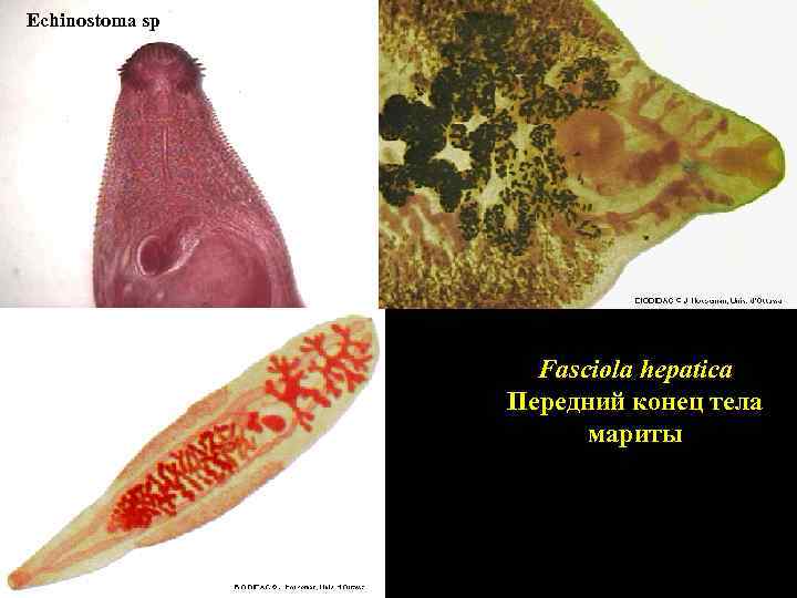 Echinostoma sp Fasciola hepatica Передний конец тела мариты 