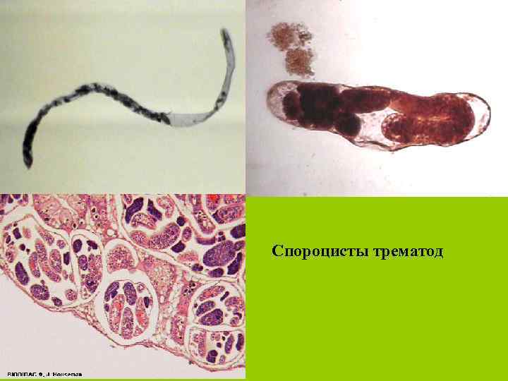 Спороцисты трематод 