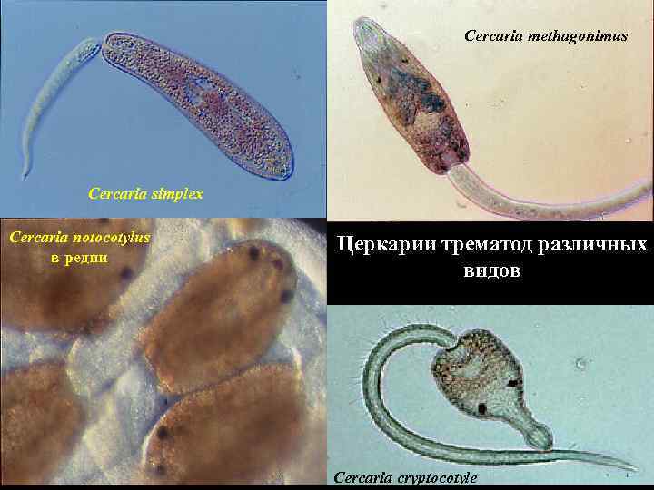 Cercaria methagonimus Cercaria simplex Cercaria notocotylus в редии Церкарии трематод различных видов Cercaria cryptocotyle