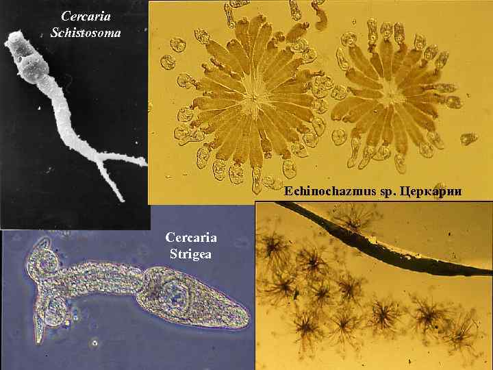 Cercaria Schistosoma Echinochazmus sp. Церкарии Cercaria Strigea 