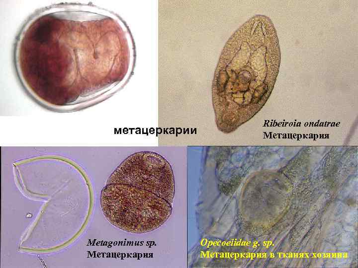 метацеркарии Metagonimus sp. Метацеркария Ribeiroia ondatrae Метацеркария Opecoelidae g. sp. Метацеркария в тканях хозяина