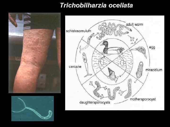 Trichobilharzia ocellata 