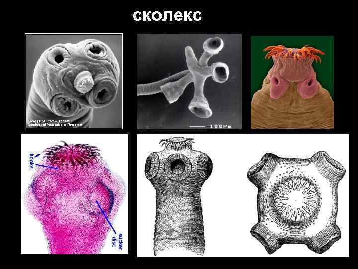 Сколекс бычьего цепня рисунок