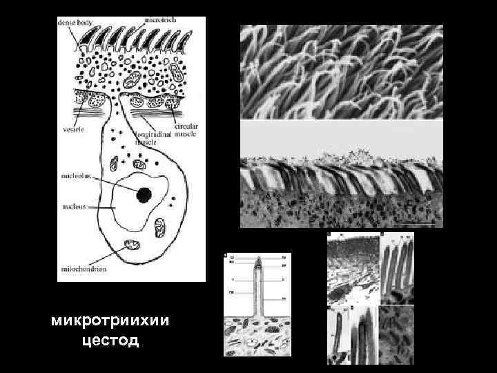 микротриихии цестод 