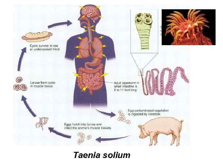 Taenia solium 