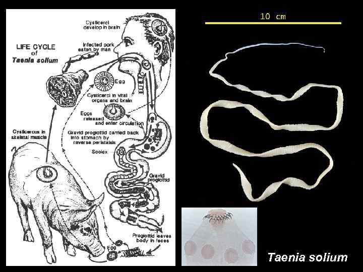 Taenia solium 