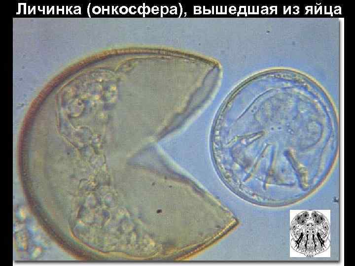 Личинка (онкосфера), вышедшая из яйца 