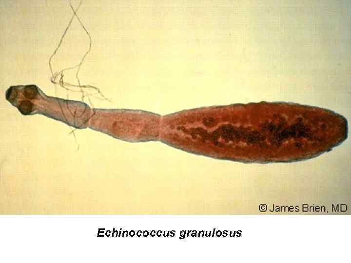 Echinococcus granulosus 