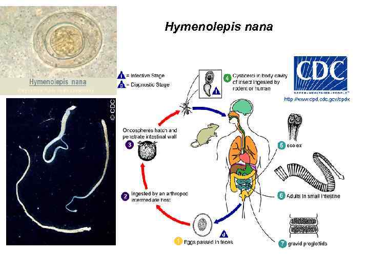 Hymenolepis nana 