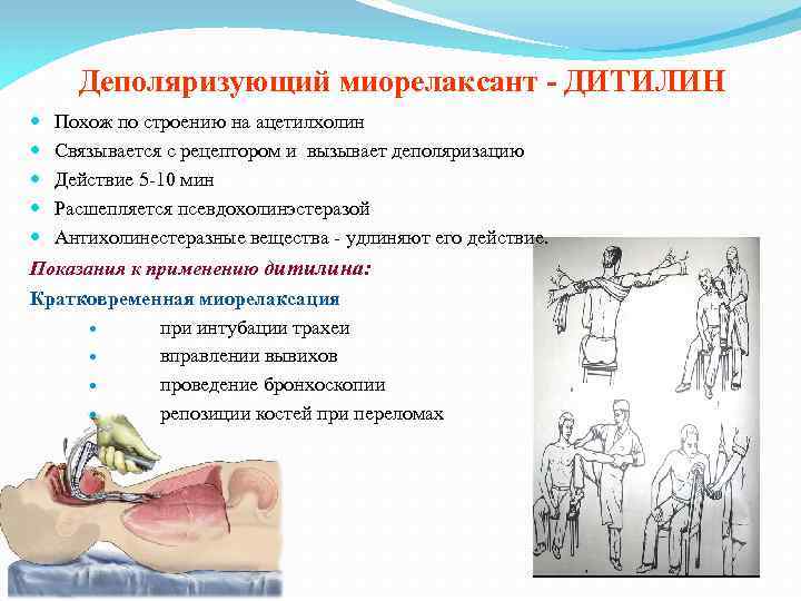 Деполяризующий миорелаксант - ДИТИЛИН Похож по строению на ацетилхолин Связывается с рецептором и вызывает