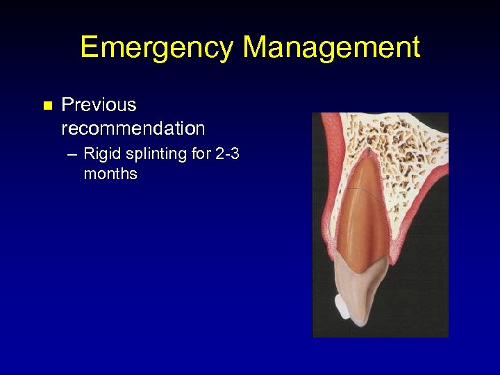 Emergency Management n Previous recommendation – Rigid splinting for 2 -3 months 