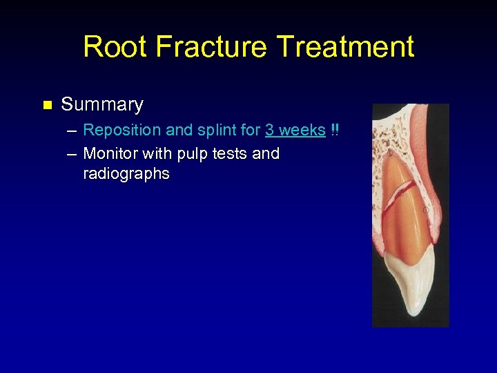 Root Fracture Treatment n Summary – Reposition and splint for 3 weeks !! –