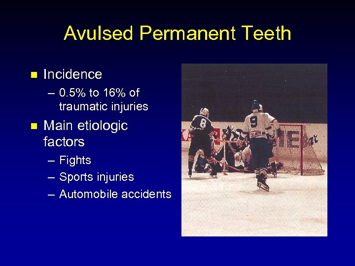 Avulsed Permanent Teeth n Incidence – 0. 5% to 16% of traumatic injuries n