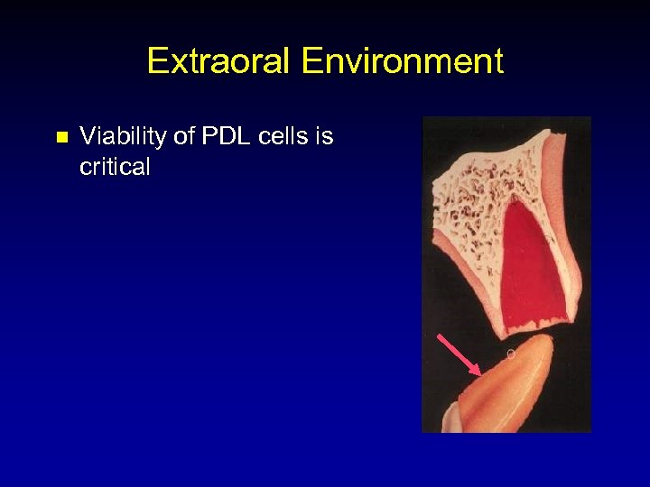 Extraoral Environment n Viability of PDL cells is critical 