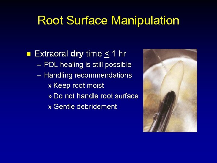Root Surface Manipulation n Extraoral dry time < 1 hr – PDL healing is